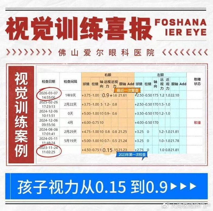 佛山爱尔李亮亮博士:用个性化视觉训练,帮孩子“练眼力”